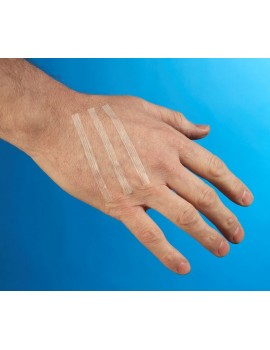 Steroplast Wound Closures, Hypo Sutures Pack 30  Plasters